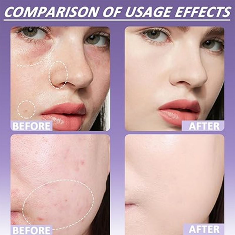 Matter Concealer für Gesicht & Körper